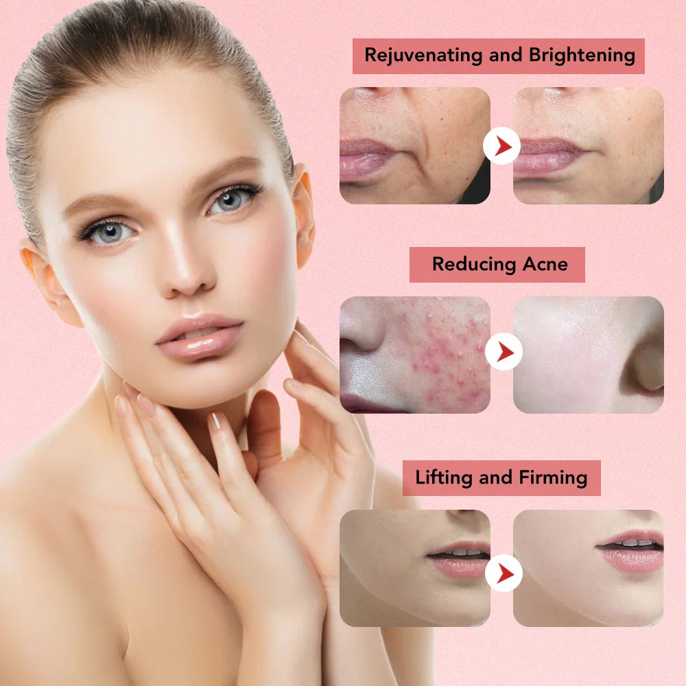 RejuvaLift™ 7-in-1 Beauty System