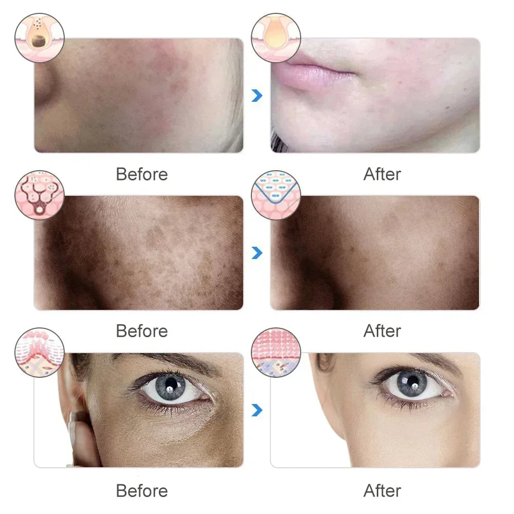 LumiLift™ LED Therapy Mask Essential